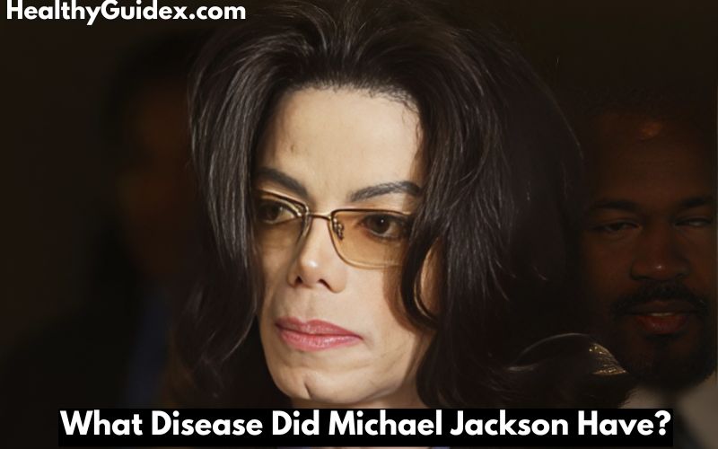 What Disease Did Michael Jackson Have